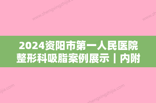 2024资阳市第一人民医院整形科吸脂案例展示｜内附体验效果图