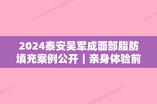 2024泰安吴军成面部脂肪填充案例公开｜亲身体验前后对比图分享