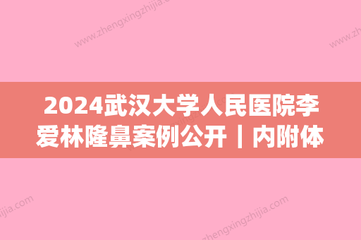 2024武汉大学人民医院李爱林隆鼻案例公开｜内附体验效果图(湖北省人民医院李爱林做鼻子)