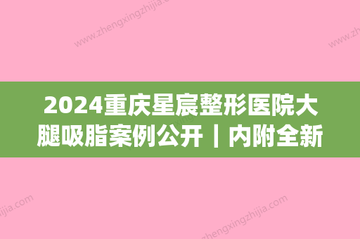 2024重庆星宸整形医院大腿吸脂案例公开｜内附全新体验效果图(重庆星宸整形医生)