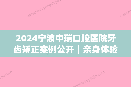 2024宁波中瑞口腔医院牙齿矫正案例公开｜亲身体验前后效果图分享(宁波中瑞牙科医院)