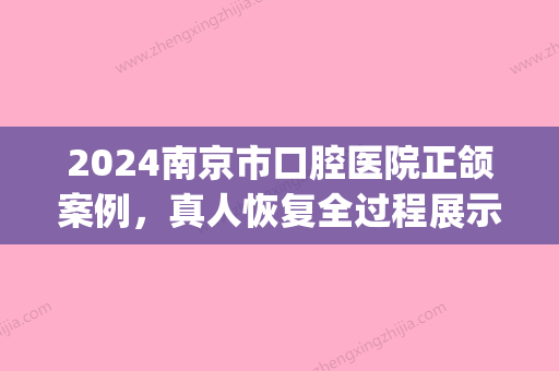 2024南京市口腔医院正颌案例	，真人恢复全过程展示2024(南京市口腔医院正颌失败)