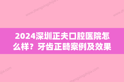 2024深圳正夫口腔医院怎么样？牙齿正畸案例及效果图公布(深圳牙齿正畸医生推荐)