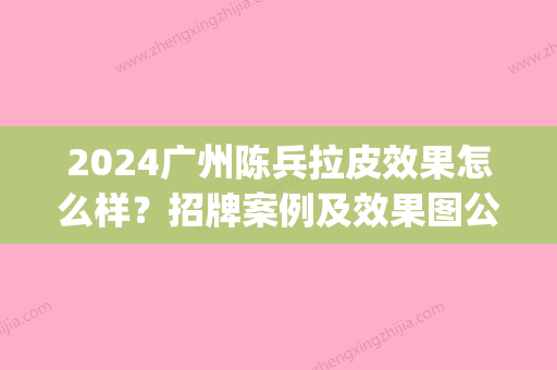 2024广州陈兵拉皮效果怎么样？招牌案例及效果图公布(广州陈兵拉皮手术效果如何)