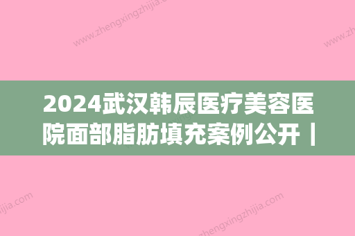 2024武汉韩辰医疗美容医院面部脂肪填充案例公开｜附前后对比图(武汉韩辰整形是正规医院吗)