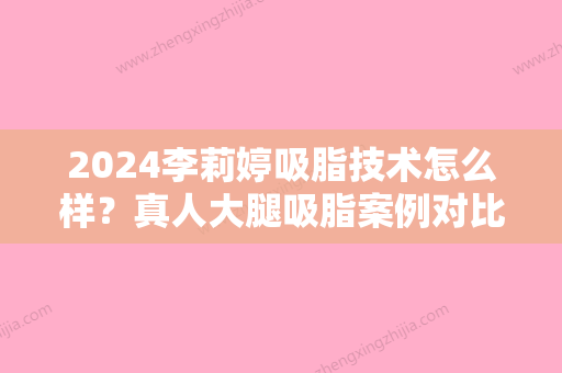 2024李莉婷吸脂技术怎么样？真人大腿吸脂案例对比照片来解答