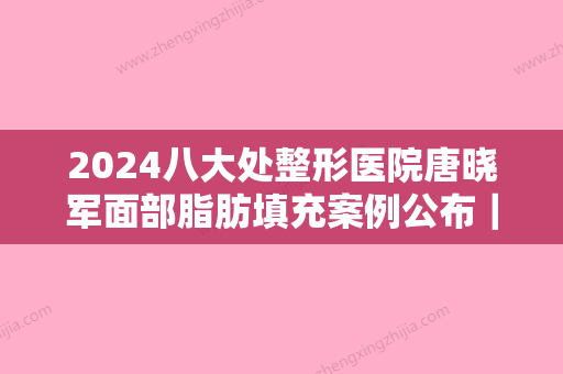 2024八大处整形医院唐晓军面部脂肪填充案例公布｜附体验对比图