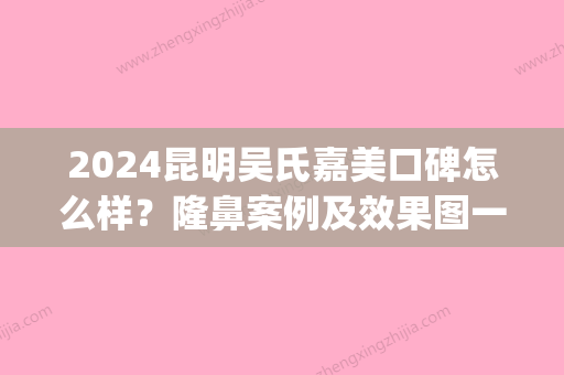 2024昆明吴氏嘉美口碑怎么样？隆鼻案例及效果图一览(昆明吴氏嘉美整形医院正规吗)