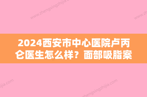 2024西安市中心医院卢丙仑医生怎么样？面部吸脂案例案例分享