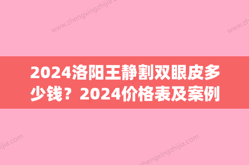 2024洛阳王静割双眼皮多少钱？2024价格表及案例一览(洛阳三院双眼皮价格)