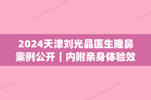 2024天津刘光晶医生隆鼻案例公开｜内附亲身体验效果图(天津刘光晶双眼皮案例)