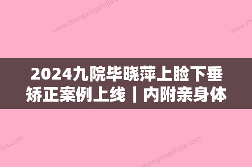 2024九院毕晓萍上睑下垂矫正案例上线｜内附亲身体验感悟