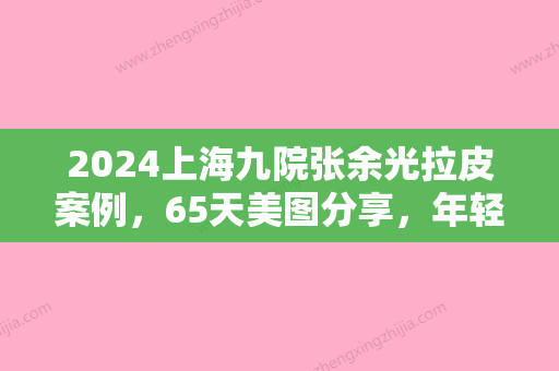 2024上海九院张余光拉皮案例	，65天美图分享，年轻不少