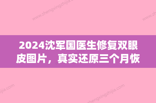 2024沈军国医生修复双眼皮图片	，真实还原三个月恢复血泪史(沈阳陈军双眼皮修复怎么样)