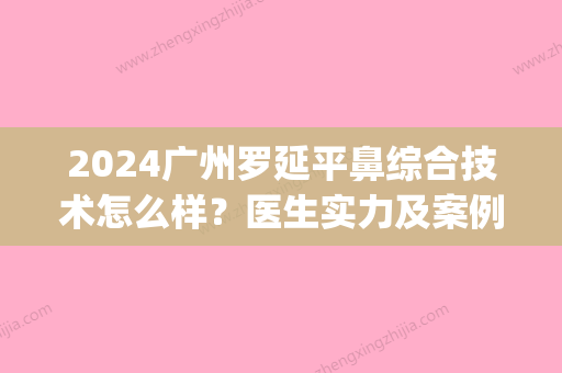 2024广州罗延平鼻综合技术怎么样？医生实力及案例分享(广州罗延平做的鼻子案例)