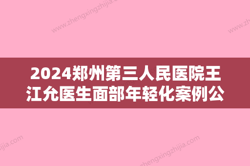 2024郑州第三人民医院王江允医生面部年轻化案例公布｜效果自然美观