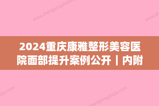 2024重庆康雅整形美容医院面部提升案例公开｜内附体验效果图(康美美容整形)