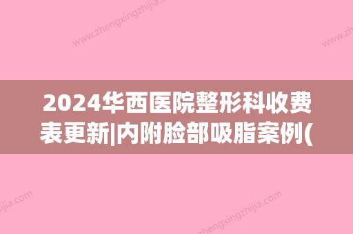 2024华西医院整形科收费表更新|内附脸部吸脂案例(华西医院吸脂大概多少钱)