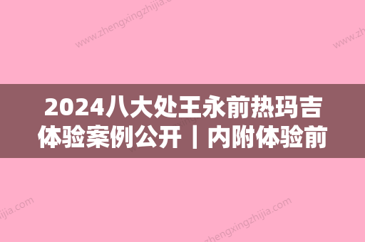 2024八大处王永前热玛吉体验案例公开｜内附体验前后对比图