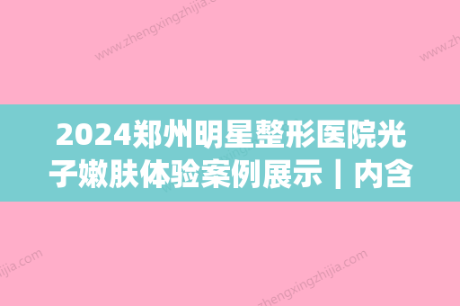 2024郑州明星整形医院光子嫩肤体验案例展示｜内含前后对比图(郑州哪个医院可以做光子嫩肤)