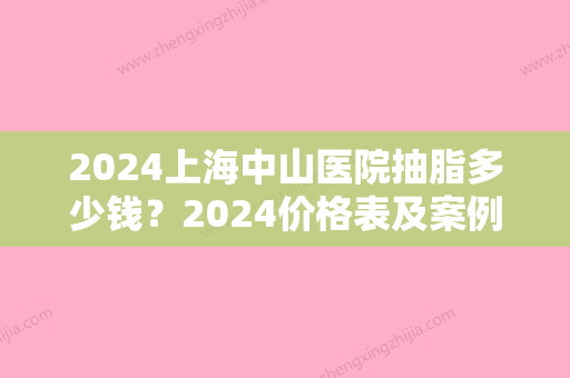 2024上海中山医院抽脂多少钱？2024价格表及案例一览