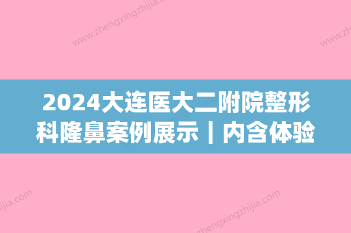 2024大连医大二附院整形科隆鼻案例展示｜内含体验前后效果图(大连医大二院整容科)