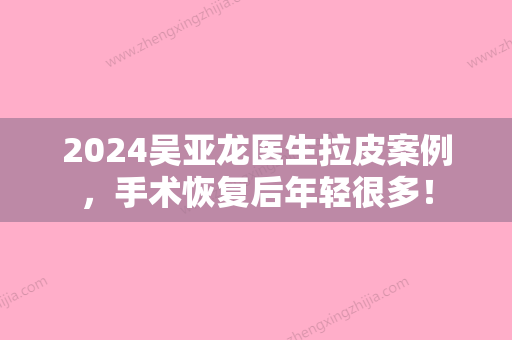 2024吴亚龙医生拉皮案例，手术恢复后年轻很多！