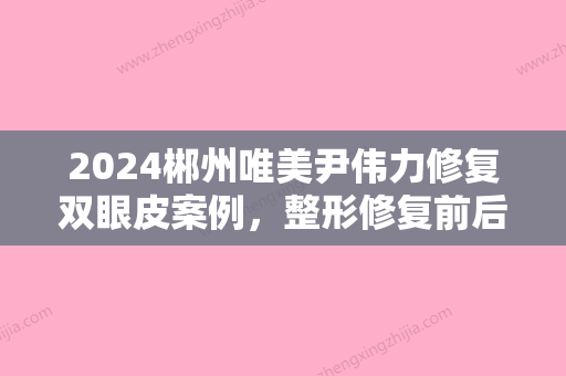 2024郴州唯美尹伟力修复双眼皮案例，整形修复前后对比图片展示