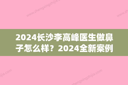 2024长沙李高峰医生做鼻子怎么样？2024全新案例曝光(长沙李时雨做鼻案例)