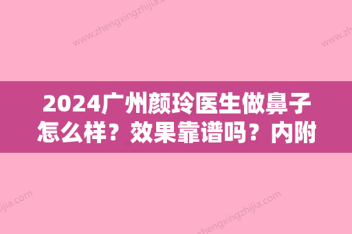 2024广州颜玲医生做鼻子怎么样？效果靠谱吗？内附全新体验案例