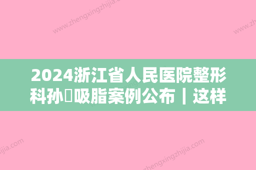 2024浙江省人民医院整形科孙燚吸脂案例公布｜这样的效果你想要吗