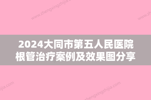 2024大同市第五人民医院根管治疗案例及效果图分享｜速览