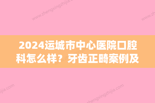 2024运城市中心医院口腔科怎么样？牙齿正畸案例及效果图公布(运城市中心医院口腔外科医生)