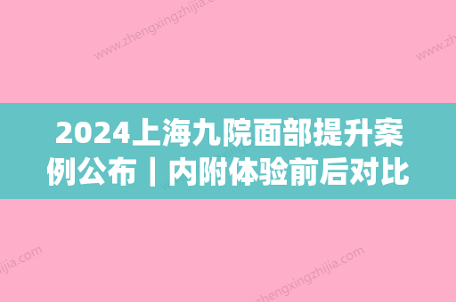 2024上海九院面部提升案例公布｜内附体验前后对比图(上海九院全脸提升术)