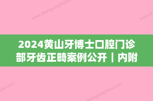 2024黄山牙博士口腔门诊部牙齿正畸案例公开｜内附体验细节图(黄山牙齿矫正医院)