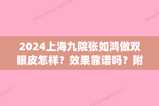 2024上海九院张如鸿做双眼皮怎样？效果靠谱吗？附案例(上海九院做双眼皮修复好吗)