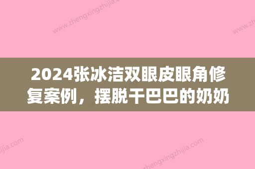 2024张冰洁双眼皮眼角修复案例，摆脱干巴巴的奶奶眼(张冰洁修复外眼角视频)