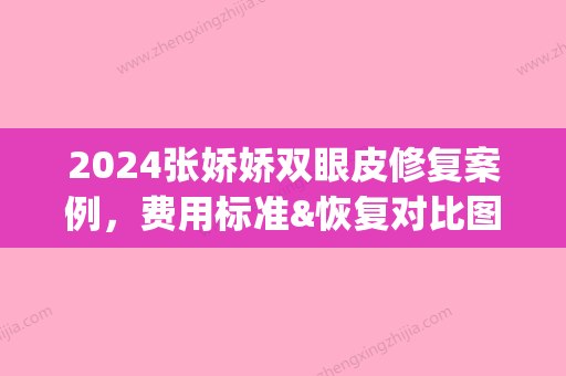 2024张娇娇双眼皮修复案例，费用标准&恢复对比图片(双眼皮失败修复案例图)