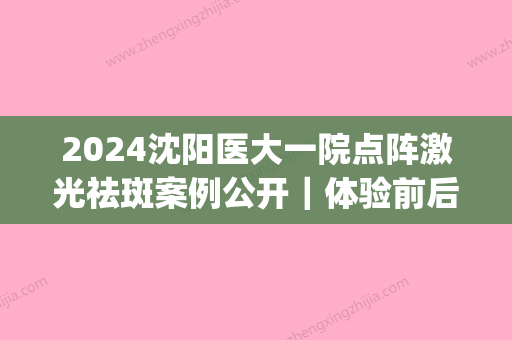 2024沈阳医大一院点阵激光祛斑案例公开｜体验前后效果让人惊讶(沈阳医大一院激光祛斑多少钱)