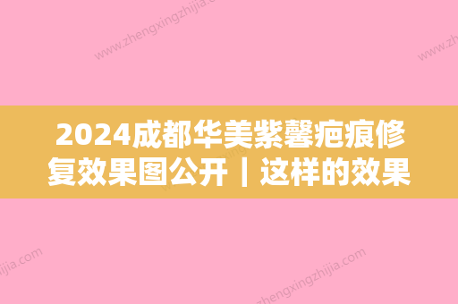 2024成都华美紫馨疤痕修复效果图公开｜这样的效果是你想要的吗？