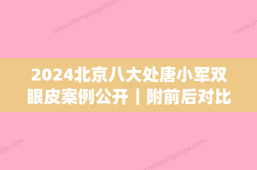 2024北京八大处唐小军双眼皮案例公开｜附前后对比图(八大处整形双眼皮专家)