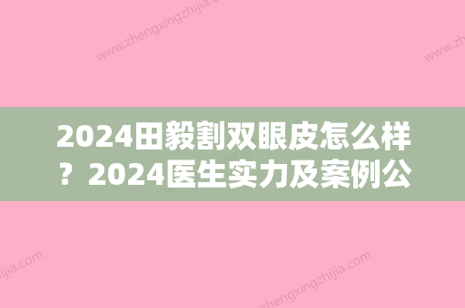 2024田毅割双眼皮怎么样？2024医生实力及案例公布