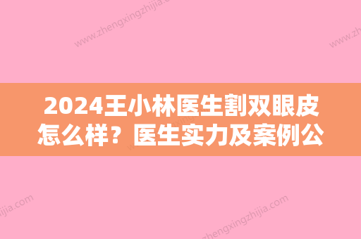 2024王小林医生割双眼皮怎么样？医生实力及案例公开