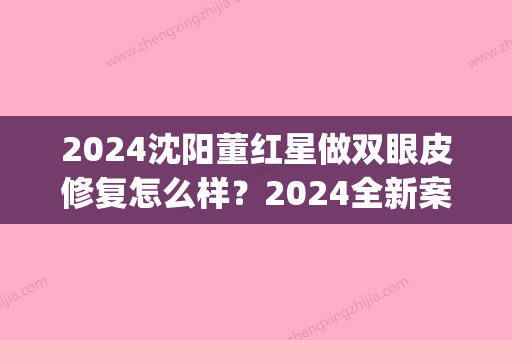 2024沈阳董红星做双眼皮修复怎么样？2024全新案例分享(董红星双眼皮做的咋样)