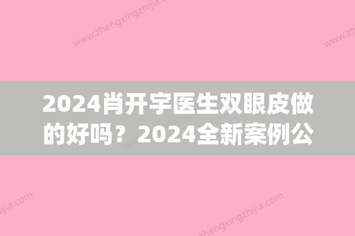 2024肖开宇医生双眼皮做的好吗？2024全新案例公布(肖开颜双眼皮)