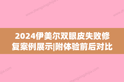 2024伊美尔双眼皮失败修复案例展示|附体验前后对比图(伊美尔整形双眼皮价格)