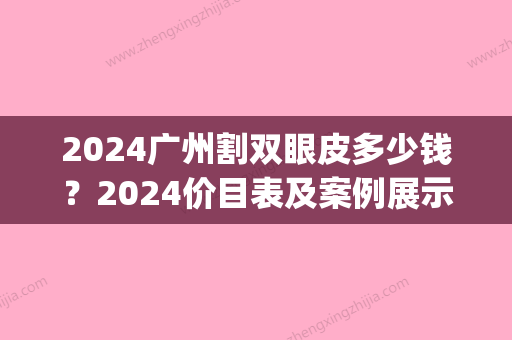 2024广州割双眼皮多少钱？2024价目表及案例展示(广州割双眼皮需要多少钱一次)