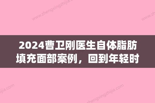 2024曹卫刚医生自体脂肪填充面部案例，回到年轻时代(九院曹卫刚全脸脂肪填充价格)