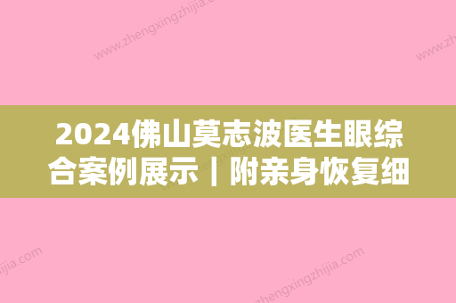 2024佛山莫志波医生眼综合案例展示｜附亲身恢复细节图