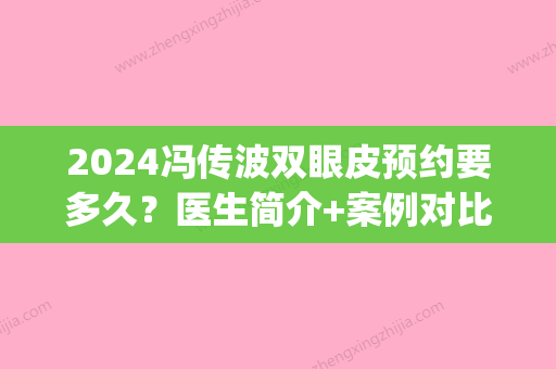 2024冯传波双眼皮预约要多久？医生简介+案例对比图(冯传波双眼皮价格)